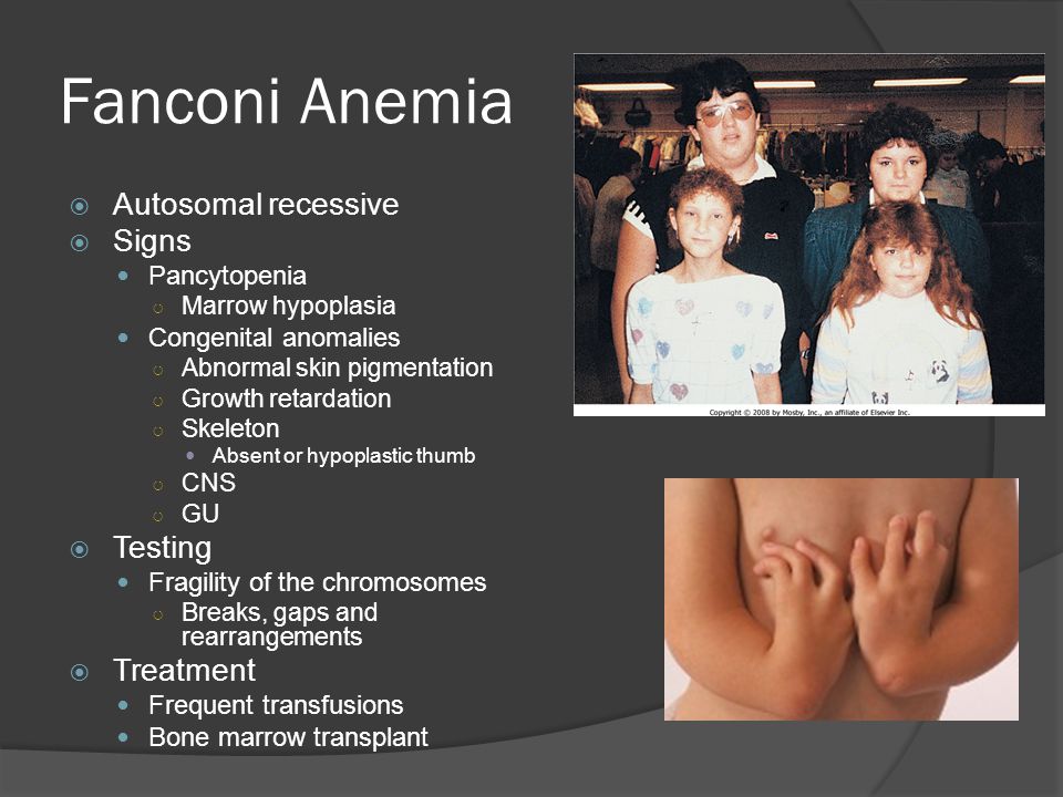 Fanconi anemia chromosome breakage analysis essay